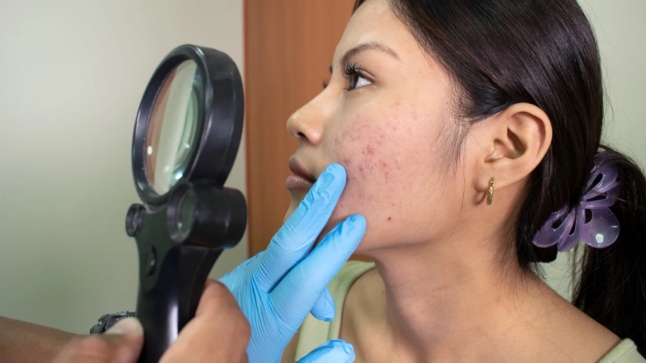 todo sobre la dermatología